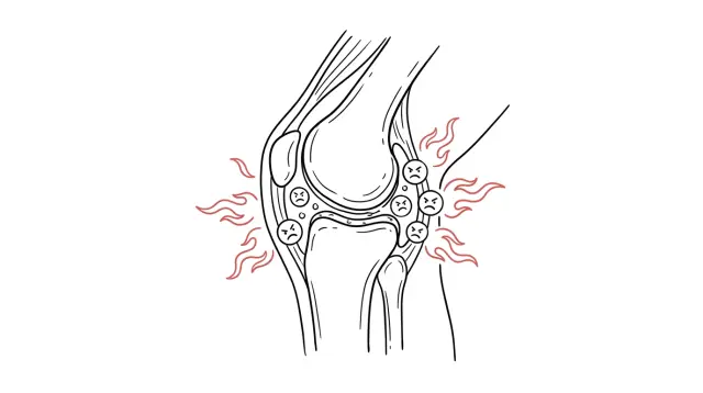 Your Knee Pain Isn't "Getting Old" — It's Your Immune Cells Setting Fires