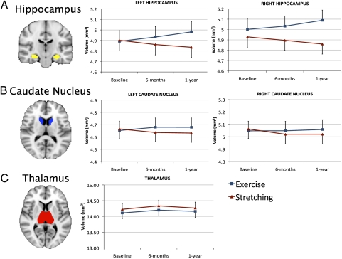 Erickson et al. (2011) Figure 1：運動組海馬迴體積上升 vs 對照組下降